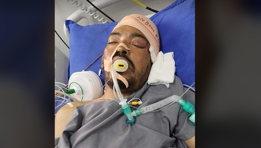बौद्धटुसालमा माइक्रोबसको ठक्करबाट घाइते भएका यी ब्यक्तिको पहिचान हुन सकेन